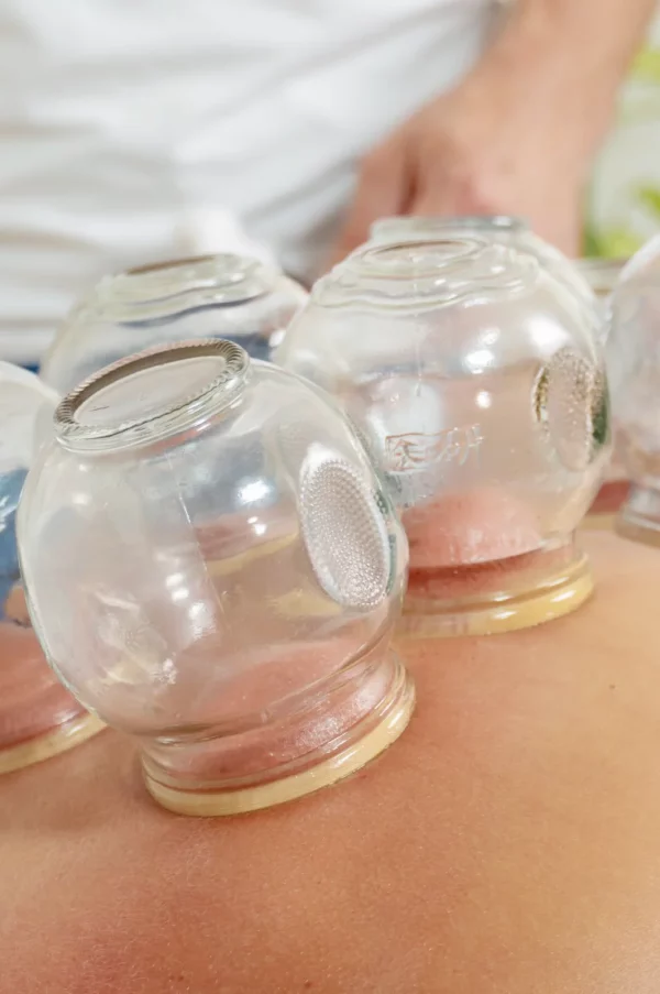 Médecine chinoise et ventouse à Nyon